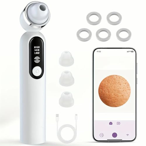 NYSDM Blackhead Remover Vacuum Interfaccia USB Strumento di Estrazione del Vuoto dei pori Pulitore della Fotocamera 3 modalità di Regolazione 3 testine di aspirazione