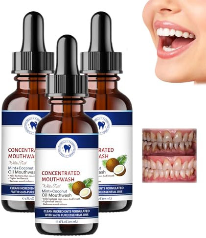Ourlyard Kokosnussöl Mundspülung Ätherisches Öl, Kokosnuss-Mundspülung, Kokosöl-Mundspülung, Ourlyard Coconut Oil Mouthwash Essential Oil, Ourlyard Mundspülung, Für Frischen Atem (3pcs)