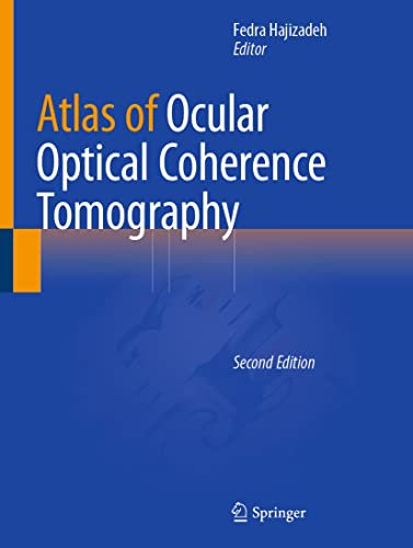 Atlas of Ocular Optical Coherence Tomography (English Edition)