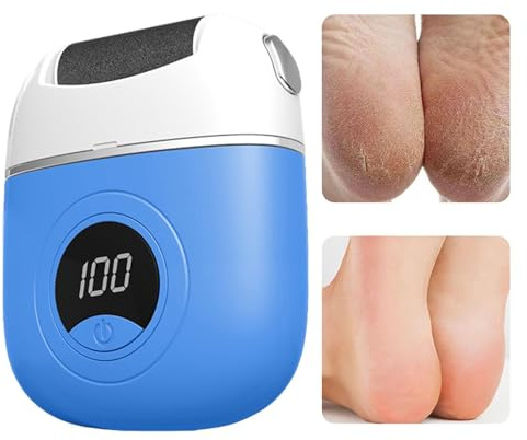Molinillo Eléctrico Para Pies, Removedor De Callos Para Los Pies, Removedor De Piel Muerta Pies, Cuidado De Pies Durezas, Limas Electrónica Para Pies Para Dedos De Pies,talones,plantas, USB Recargable