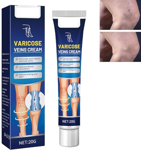 Varicose Vein Crème,Veins Cream,Idratante Per Vene Varicose,Crema Vene Varicose,Vene Varicose,Riduce Le Vene Varicose,Crema Per La Cura Delle Gambe,Crema per Vene Varicose