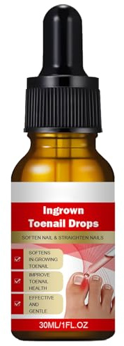 Fungo Unghie Piedi,Nail Repair Olio Essenziale,Trattamento Unghie Piedi,Trattamento Anti Fungus Nail Fungal,Trattamento Antimicotico,Soluzione per la Cura Delle Unghie,Trattamento Unghie 30ML