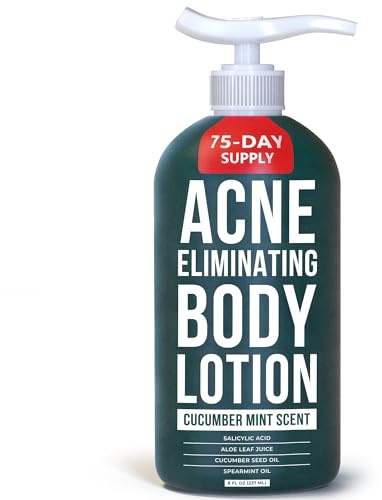 TreeActiv Acne Eliminating Body Lotion 8 fl oz | Clears Body, Back, Butt and Shoulder Acne | Anti-Acne Moisturizer | Prevents Future Breakouts | Cucumber Mint Scent