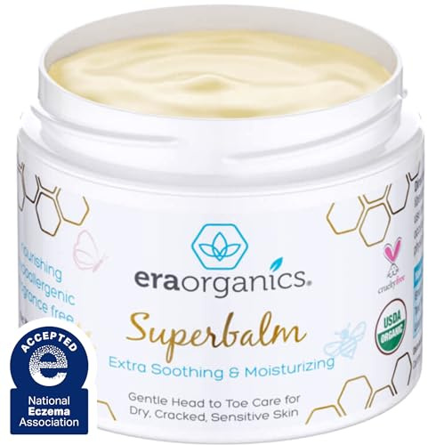 Era Organics Healing Ointment for Babies - USDA Certified Organic Natural Moisturizer Gentle on Sensitive Skin Prone To Baby Eczema, Cradle Cap (Infant Seborrheic Dermatitis), Rashes, Hives and More