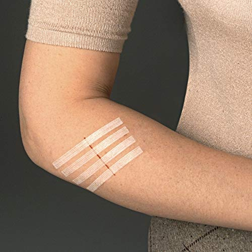 Butterfly Stitches Skin Closures – Mixed Sizes First Aid Refill Pack