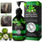 Valleylux Jamaikanisch Schwarz Rizinusöl Shampoo, Castor Oil Shampoo für Haarwachstum, Bio-Shampoo Gegen Haarausfall mit Biotin, Tiefenreinigung, Reparierendes und Befeuchten Frauen Männer, 300ml