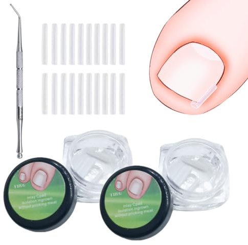 101 Piezas Corrección de Uñas Encarnadas Set, Correctoras de Uñas Encarnadas con Levantador de Uñas, Kit de Corrección de Uñas los Pies de Plástico para Cuidado del Pie en Mujeres, Hombres