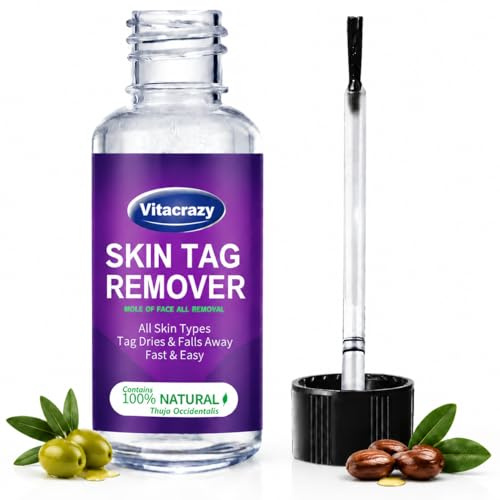 Skin Tag Removal Kit, Skin Tag Remover for Face and Body, Fast Acting Wart Remover Liquid, Painless Home Treatment, Gentle Alternative to Freeze Off Methods, 30ml (Pack of 1)
