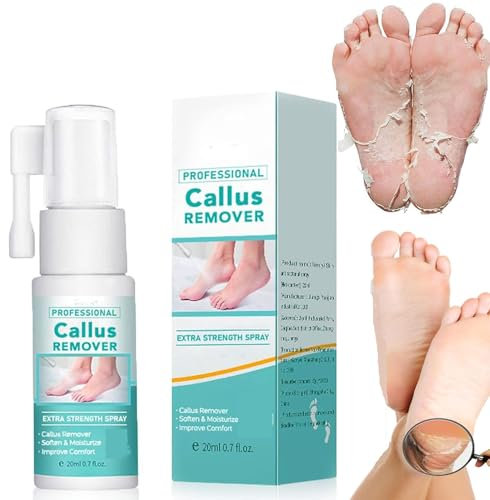Professioneller Fuß-Hornhautentferner, extra starkes Spray, Fuß-Peeling-Spray, Öl zum Entfernen abgestorbener Haut und Schwielen (1 Stück)