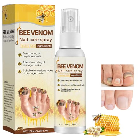 Cura delle unghie, 30ml, per Unghie Scolorite e Danneggiate e Unghie dei Piedi Spesse, Rinforza la Struttura Dell'Unghia, Proteggi Rigenerate