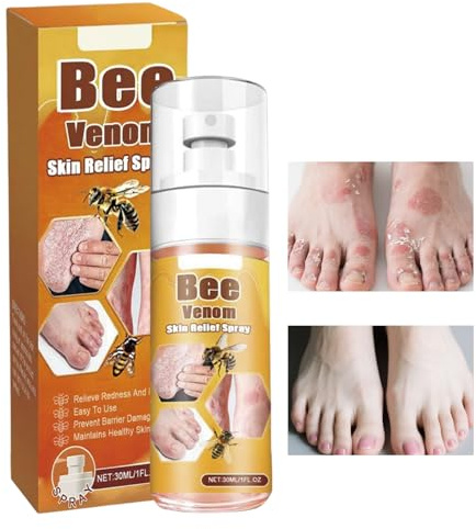 Spray de para el Picor 30ml | Reparadora de Barrera Cutánea,de Picaduras Control Olor para Niños Adultos Mujeres Hombres Viajes Exteriores Hogar