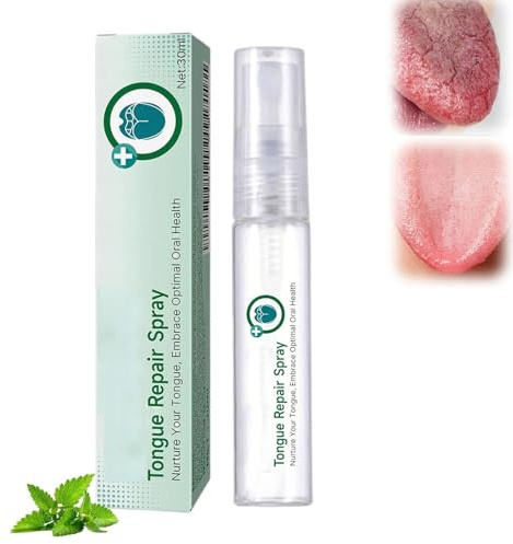 Tongue Repair Spray, Repair White Tongues Coating to Relieve Dry, erfrischt schnell den Atem, für weiße Zungen und trockenen Mund, täglicher Gebrauch (1 Pcs)