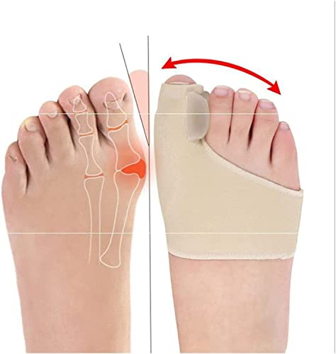 JINLINGNB 1 Paar Zehenspreizer, Hallux Valgus, Füße, Knochen, Daumen, Einsteller, Bunion Splints, Korrektor, Orthesen, Schutz, Glätteisen, Fußpflege-Werkzeug