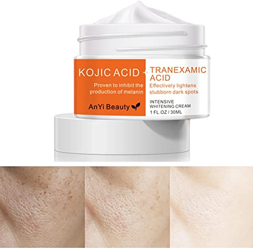 pologmase Crème Réparatrice Acnés - Éliminateur Cicatrices à Base,Acnes Scars Removal Cream, 30ml Scar Remover for Blemishing, Acnes Marks, Acnes &