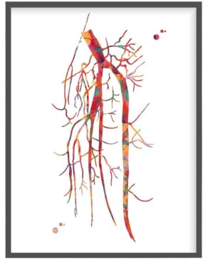 1 St Kardiologi Vaskulär Sys Affisch Angiogram Anatomi Angiologi Medicinsk Kirurgi Dukmålning Väggkonst Klinik Heminredning(2,30x40cm Unframed)