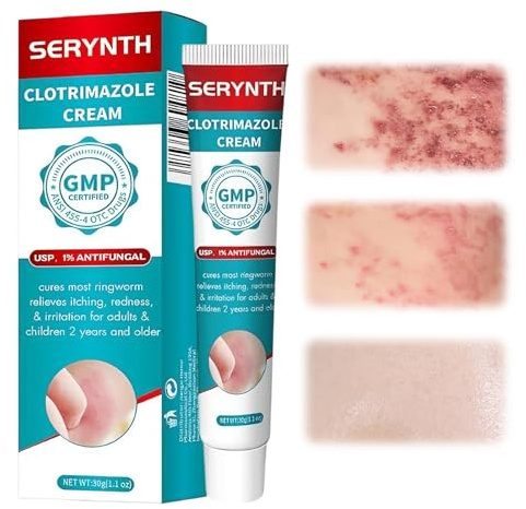 30g Crema Antipruriginosa,Crema Antifúngica, Eczema,Pomada para Calma los el malestar cutáneo,Calma la Picazón,Hidratante y Reparadora pomada Pieles,Para todo tipo de pieles