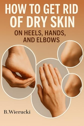 How to get rid of dry skin on heels, hands and elbows