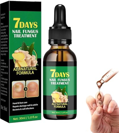 Ginger Traitement des ongles Support pour ongles, sérum de croissance des ongles au gingembre, traitement des ongles 7 jours, huile de soin des cuticules au gingembre (1 pièce)