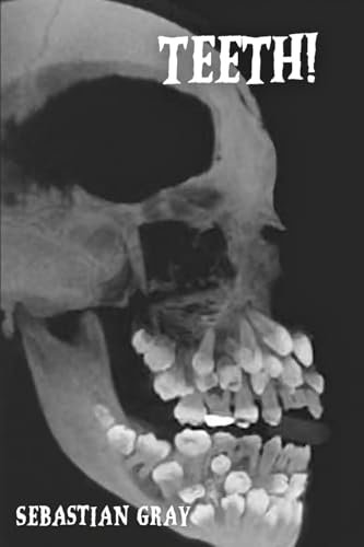 Teeth!