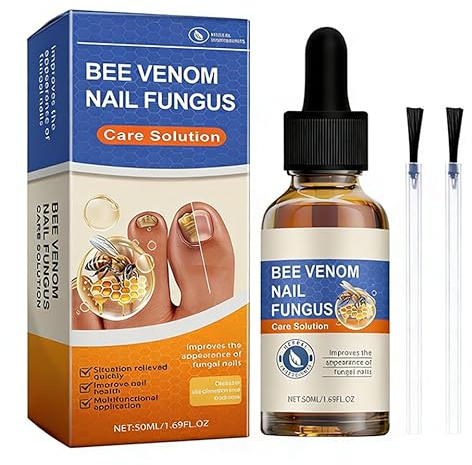 Herramienta de uñas encarnadas para hombres y mujeres - Kit de eliminación de uñas encarnadas - Gotas correctivas para uñas encarnadas - Eliminación de uñas encarnadas 50ml