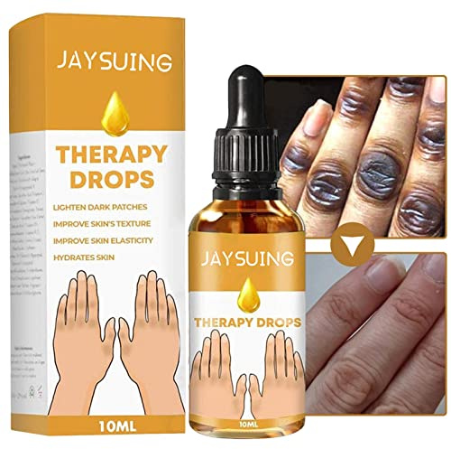 Dark Knuckle Whitenings Ätherisches Öl - Aufhellende dunkle Flecken Entfernung Body Bleaching 10ml Hautpflege - Hautaufhellungsöl, starke Aufhellungsessenz für Dark Knuckle Corrector Rianpesn