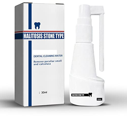 UIHECTA Dissolving Dental Spray, Dental Calculus Remover Teeth Cleaner, Mouth Refreshing Spray,Intensive Stain Removal Toothpaste Clean Mouth Dental Calculus Remover Teeth