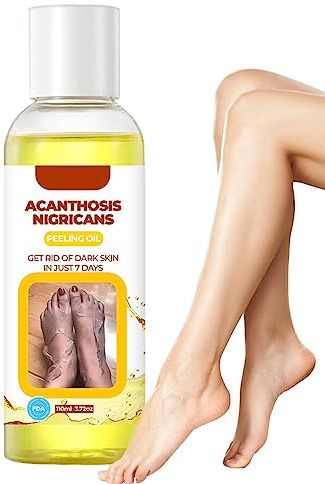 Gul Peeling Oil Extra - Gul peelingolja för mörk hy | Naturliga fläckar blekar gul peelingolja för mörk hy, 110 ml exfoliering för hyperpigmentering, jämn hudfärg Ceolup