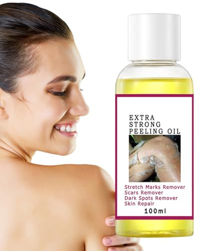 Minhaxue Olio Peeling | Olio Peeling Giallo Super Forte, per Pelle Scura, Scuro Sport Remover Adatto per Mani e Piedi
