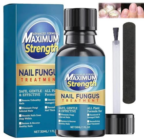 Nail Fungus Treatment For Toenail, Extra Strong Fungal Nail Treatment For Toenails, Effective Antifungal Solution To Strengthen & Revitalize Damaged, Broken, Discolored Nails, 30Ml