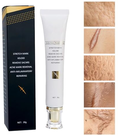 Crema Para Cicatrices Facial | Absorción Rápida Y No Grasa - Crema De Cuidado Facial Para Cicatrices | Para Mejillas Brazos Manos Cuello Adolescentes Adultos Mujeres Hombres Ancianos