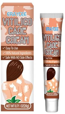 Crema Per La Cura Della Vitiligine, 20 G Di Crema Per Sollievo Dalla Vitiligine, Per Macchie Bianche Sulla Pelle,da Applicare Per Macchie Bianche Sulla Pelle Migliora I