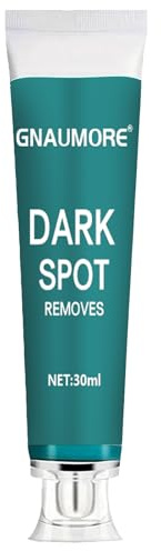 Dunkle Flecken Melasma Reparatur Entferner Creme,Gesichtscreme Gegen Dunkle Flecken,Creme für Sommersprossen,Pflegende Hautaufhellungscreme,Dunkle Flecken Gesicht Entfernen,30ml