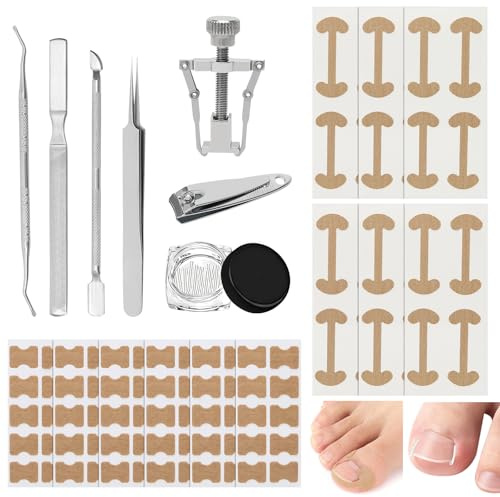 Invuxna tånaglar set, 120 stycken tånagelkorrigeringsset med nagelkorrigeringslapp, nagelklippare i rostfritt stål, nagelspäde, nagelfil, pincett, fotvårdsverktygsset för smärtlindring