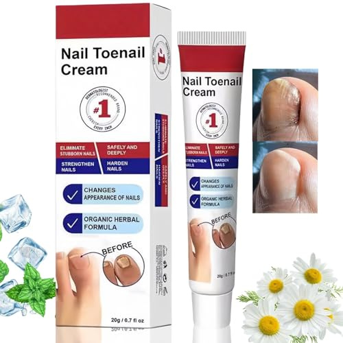 Fungal Nail Treatment Cream,Nail Fungus Treatment for Toenail,Strong Anti-Fungal Toenail Cream,Foot Cream with Nourishing Oils,Nail Repair Cream for Toenail,Effective Moisture,Suitable for Everyone