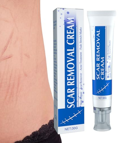 FASSME Crema para estrías, Crema Suavizante para Cicatrices 30g para Cicatrices Viejas, Suavizar Cicatrices Reduce la Cicatrices Viejas y Nuevas para niños y Adultos