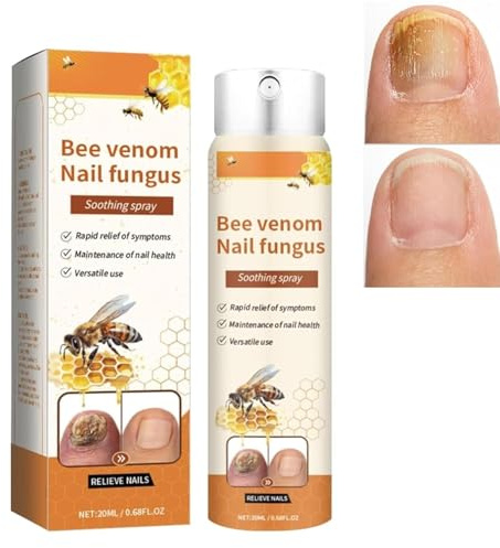 Spray avanzato per la riparazione delle unghie, spray lenitivo al veleno d'api contro i funghi delle unghie, estratti di ingredienti naturali, delicato ed efficace (1pcs)