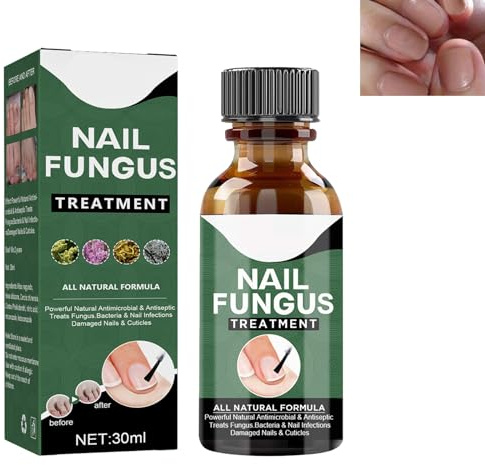 GNAUMORE Soluzione per La Riparazione delle Unghie del Piede,Nail Repair Olio Essenziale,Funghi Unghie Trattamento,Liquido Fungo per Unghie,Trattamento Funghi per Unghie