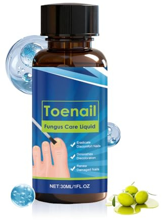 Nagelpflege für Frauen | 30 ml Lösung zur Reparatur von Fußnägeln – natürliche Reparaturflüssigkeit für die Füße – für Männer und Frauen, professionelle Schönheitsliebhaber, aktiv