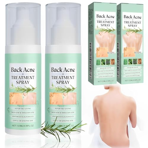 2 Stück Akne Komplex Spray, Akne Rücken Spray, Back Acne Treatment Spray, Rücken Akne Kräuterspray, Tiefenreinigung des Rückens, Akne-Behandlungsspray