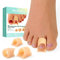 Welnove Hammertoe Corrector - 6 Pack Toe Splints - Soft Gel Toe Straighteners - Realign Bent, Curled, Crooked, Claw, Hammer Toes - Toe Corrector for Men and Women, 3 Different Sizes(Beige)