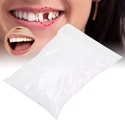 Zahnersatz Provisorischer Zähne, Instant Furniere Zahnersatz, Thermal Klebend Perlen, Temporäre Zahn Reparatur Set für Befestigen Fehlend Gebrochen Zahn Gefälscht Zahn Furnier (50g)