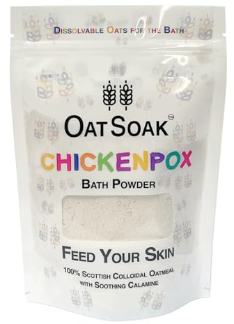 300g OatSoak Chicken Pox Relief Bath Powder with Soothing Calamine, Dissolvable Oats, Instant Itch Relief, No Mess, Resealable Bag, Made by Mums in Wales, Natural, Gentle for Itchy Skin.