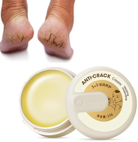 Rissfeste Creme für die Winterhaut, Cracked Skin Repair Cream, Anti Cracking und Hand und Fußcreme, Feuchtigkeitsspendende Fußcreme, Reparaturcreme für Trockene und Rissige Fersen, 15g