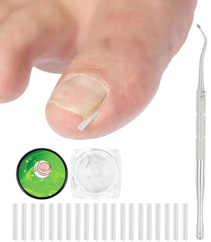 ZEXOWIJ 50 St Nagelkorrigerare För Inåtväxande Naglar, Smärtfria Utjämningsband Med Nagellyftare, Lättanvänt Verktygssats För Inåtväxande Naglar