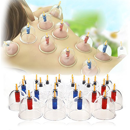 VENDEUR PRO Schröpfen Set mit 24 Schröpfgläser aus Kunststoff Glas Cupping Set Vakuum Massage