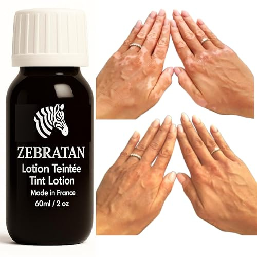 Trucco vitiligine su misura Zebratan - 60ml Beige Marrone - Lozione autoabbronzante - non grassa, non un fondotinta - mimetico piastre