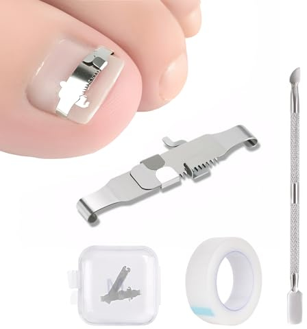 Corrección De Uña Encarnada Profesional, Corrector De Uñas Encarnadas De Acero Inoxidable, Soporte Curvo Para Hombres Y Mujeres Uñas De Los Pies Para Uñas Encarnadas Y Tratamien (M)