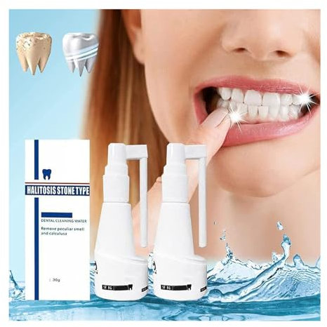 Calculusfree, spray dentale dissolubile, per rimuovere il calcolo dentale, spray rinfrescante per la bocca, dentifricio intensivo per la rimozione delle macchie, irrigatore orale portatile portatile