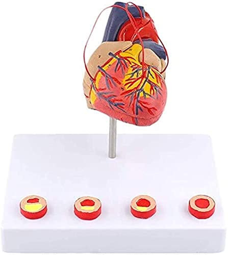 Anatomiemodell, lebensgroßes Herzmodell – menschliches Organ-Anatomiemodell. Herz-Anatomica-Modell – abnehmbares menschliches Herz-anatomisches Modell mit Sockel – kompatibel mit Studien-Dis