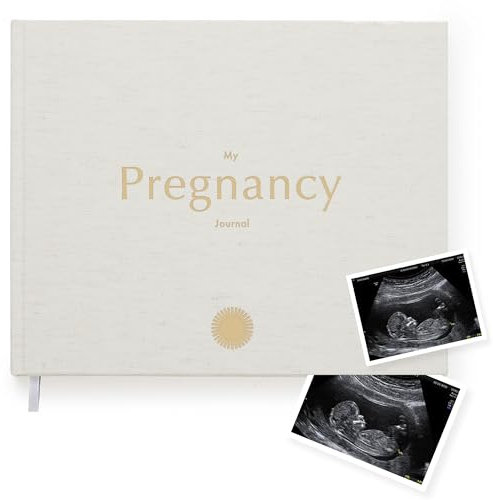 Your Edition Schwangerschaftstagebuch – Baby-Erinnerungsbuch für werdende Mütter – luxuriöses Schwangerschaftsbuch – Planer Schwangerschaftsgeschenk für erste Eltern mit Checkliste, Fotoabschnitt,